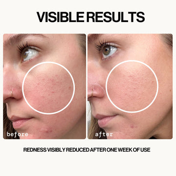 Barrier Defense Hypochlorous Acid Daily Spray - Skin Care - Pacifica Beauty