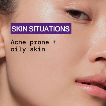 Dry It Out Acne Gel Spot Treatment - Pacifica